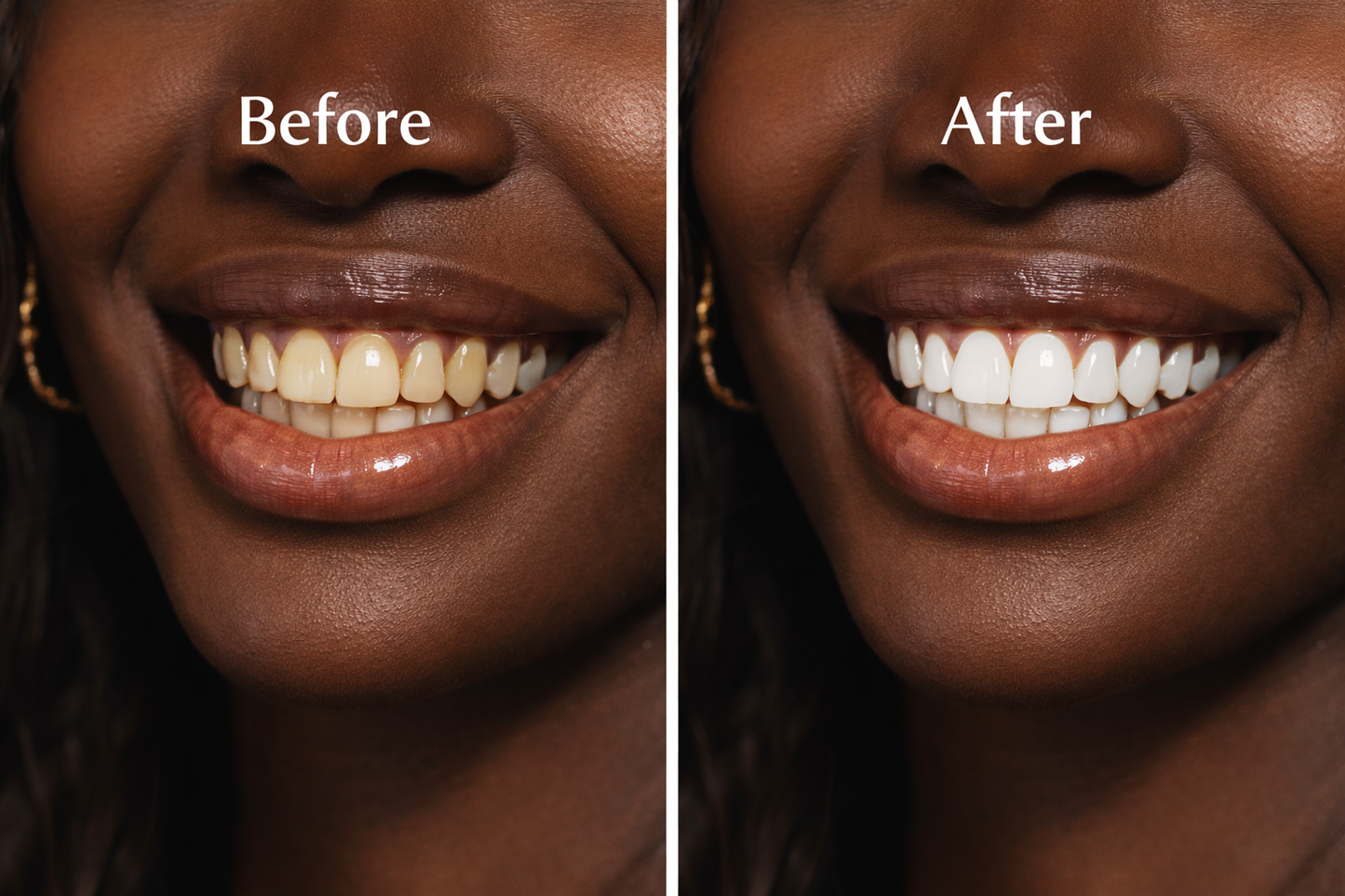 Stargirl Sacred Glow Whitening Ritual Kit